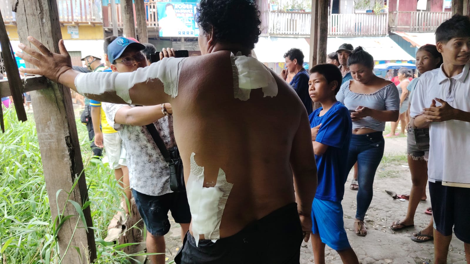 HOMBRE SUFRE QUEMADURAS AL INTENTAR SALVAR SUS PERTENENCIAS DE INCENDIO EN BELÉN
